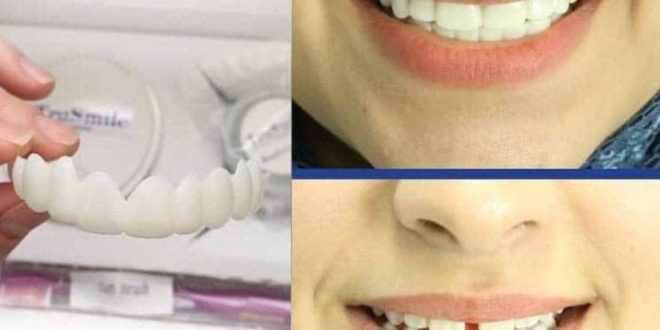 لمینت متحرک ترو اسمایل به همراه هدیه نوار چسب سفید کننده دندان
