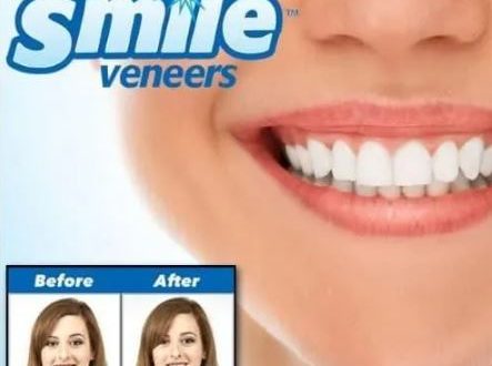 لمینت پودری sowsmile به همراه هدیه نوار چسب سفید کننده دندان