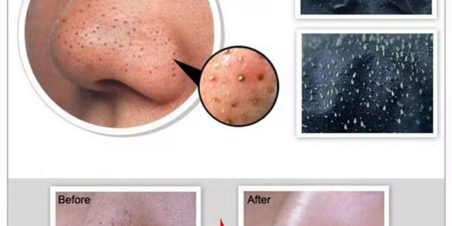 بلک ماسک ضد جوش سرسیاه بیوآکوا BIOAQUA بسته دوتایی زغال بامبو
